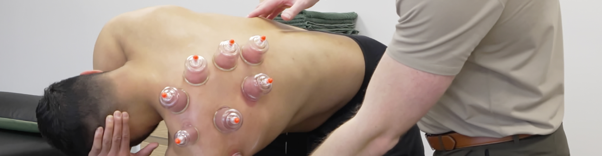 IASTM & Cupping Therapy